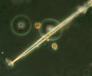 A photo of one end of the dinoflagellate Amphisolenia quadrispina.