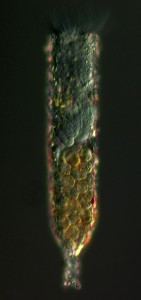 Photo of parasitic dinoflagellate Tintinnophagus acutus infecting the host Tintinnopsis cylindrica
