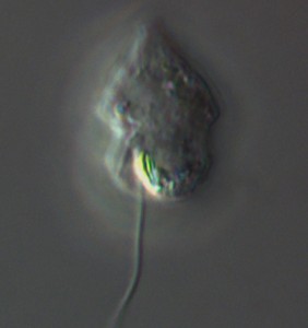 Photo of a microscopic dinospore of Tintinnophagus acutus