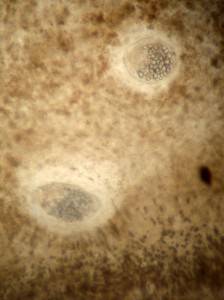 Microscopic cysts inside a Crassostrea virginica oyster. (Katrina Lohan)