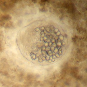 Close-up of a trematode oyster parasite. These parasites form cysts, and could be similar to the parasites that caused mass die-offs in the Chesapeake.