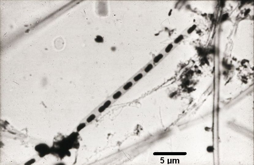 A chain of <i>Leptothrix</i> cells in a sheath, taken with a light microscope