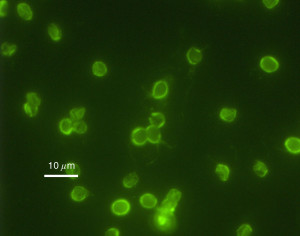 Microscopic photo of green, spherical parasites