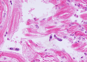 Microscopic photo of purple syndinid parasites interspersed in pink crab tissue